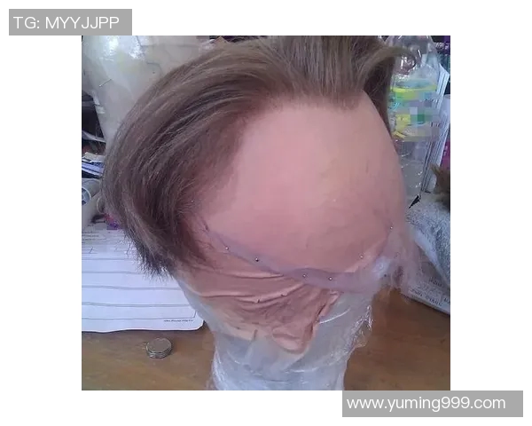 篮球明星意外现身假发造型照片引发网友热议与讨论 篮球明星意外现身假发造型照片引发网友热议与讨论